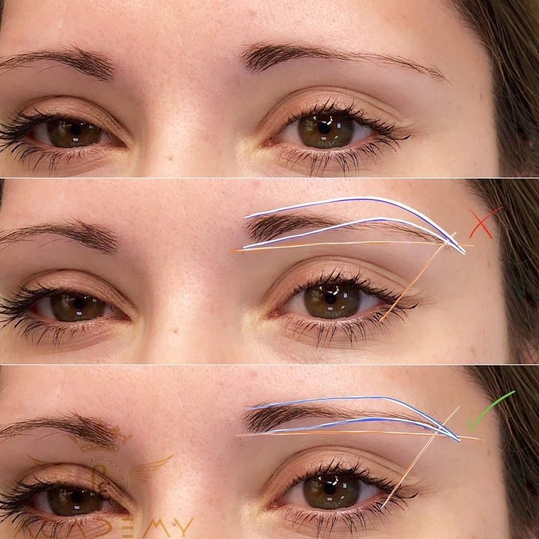 brow-forms-14.jpg